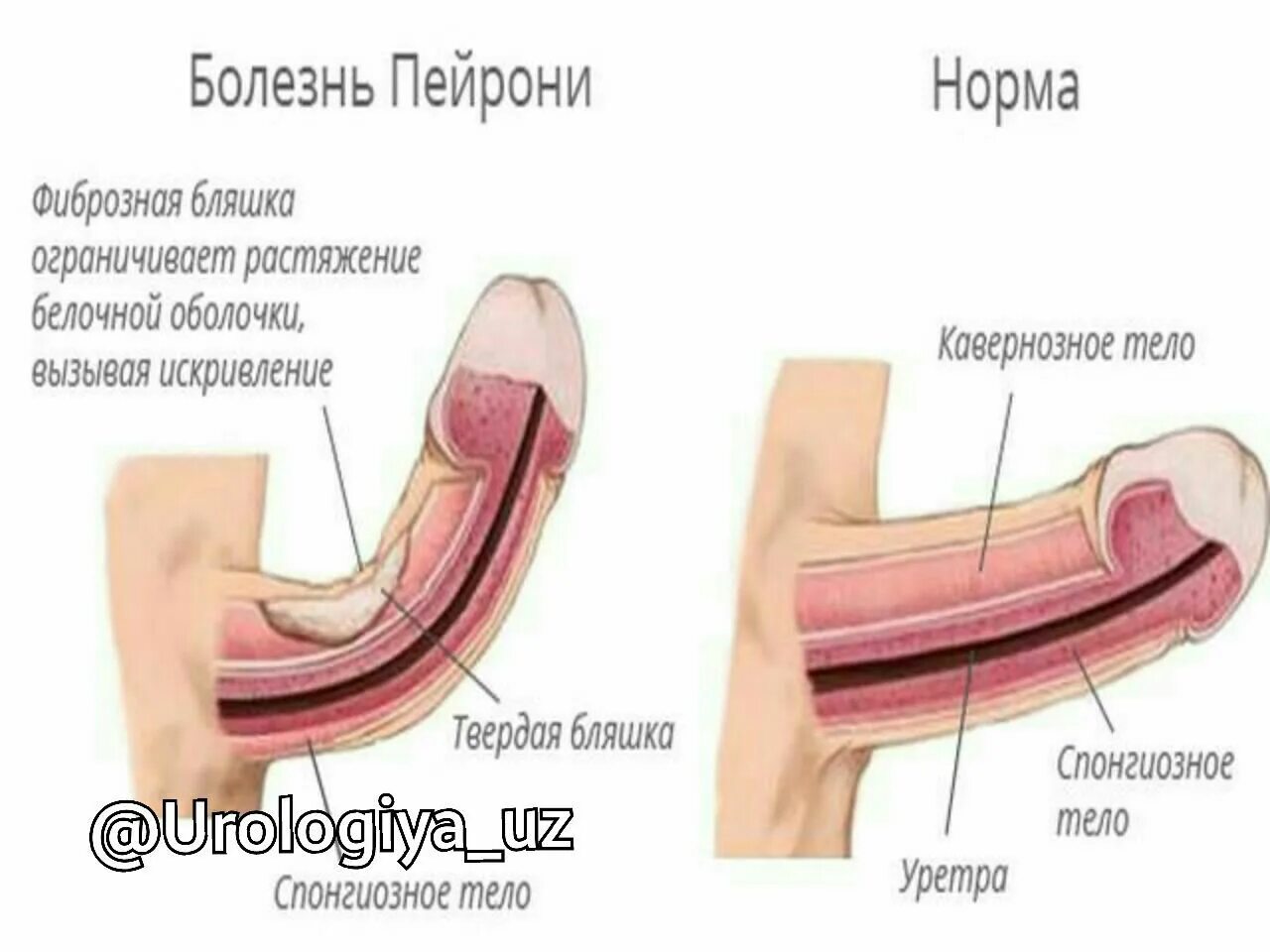 чем можно снизить чувствительность члена фото 62