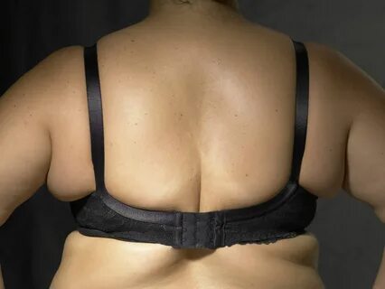 12 Simple Exercises To Reduce Bra Bulge Fat.