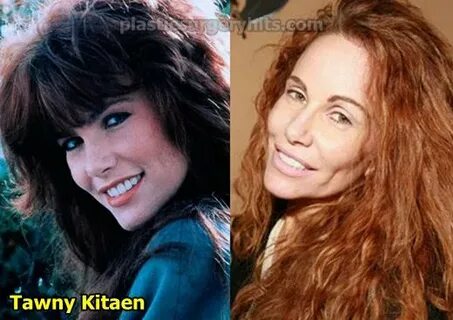 Tawny Kitaen Plastic Surgery Before and After - Plastic Surg
