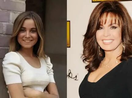 Had Marie Osmond Ever Had Plastic Surgery or Not? Let's Reve