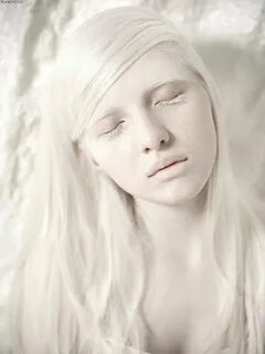 Beautiful Albino Model Related Keywords & Suggestions - Beau