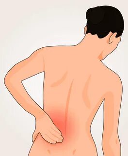 Rückenschmerzen durch Hexenschuss - Schmerzfrei werden