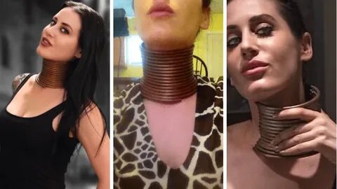 Giraffe Woman' Finally Removes 15 Rings From Her Neck Years 