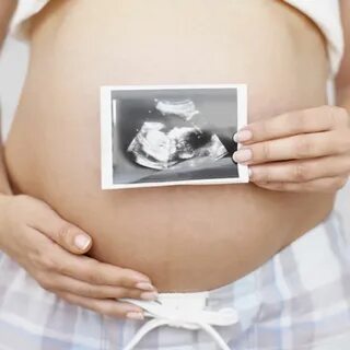 Ultraschallbilder Schwangerschaft - DIAGRAM DATABASE