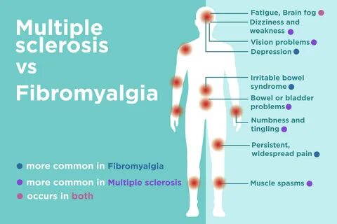 Fibromyalgia vs. Multiple Sclerosis (MS): Differences in Sig