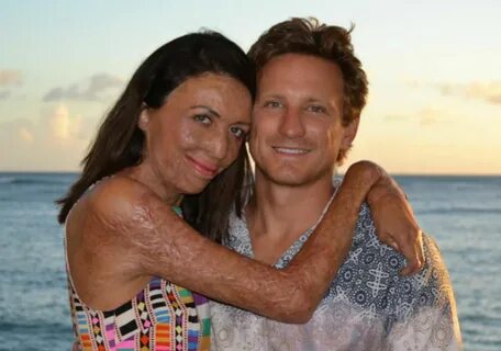 Bushfire survivor Turia Pitt tells how she got her fairytale