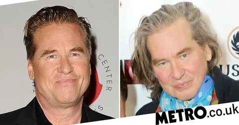 Val Kilmer looks healthy at art exhibition after throat canc