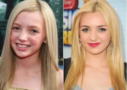 Peyton List Plastic Surgery Before and After - Celebrity Sur