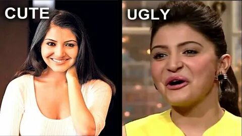 Anushka Sharma Plastic Surgery Before And After - sekho.in