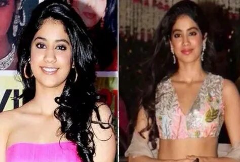 List Of Bollywood Actresses Who Have Had Plastic Surgery - प