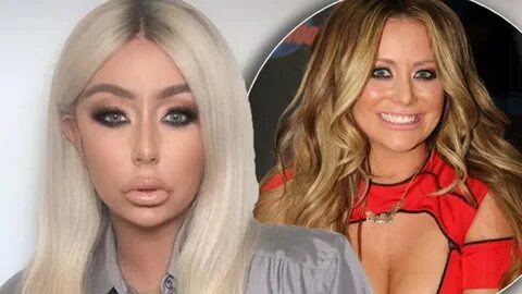 Aubrey O'Day Reveals 'Tragic' New Face After Extreme Surgery