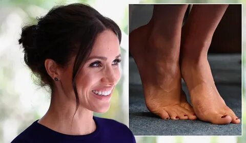 How Meghan Markle's love for heels has ruined her feet - Ext