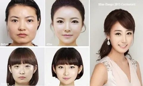 Korean Plastic Surgery Turning Women Into Clones?