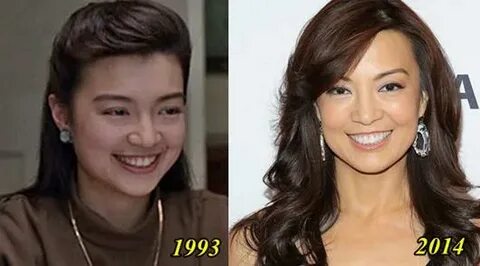 Ming Na Wen Plastic Surgery Before and After - Plastic Surge