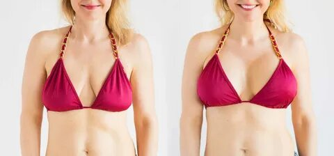 Let’s face it: Not everyone is willing to undergo a surgical breast lift ju...