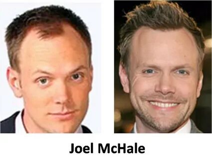 Joel Mchale Hair Transplant - driptipdesigns