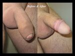 Circumcised cumshot. HD porn free site archive.