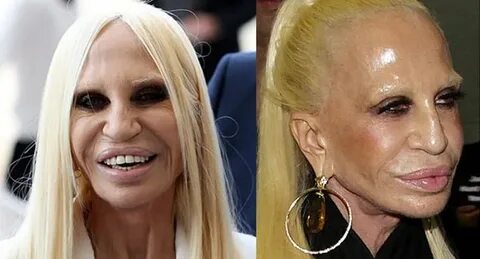 Donatella Versace Celebrities then and now, Celebrity plasti