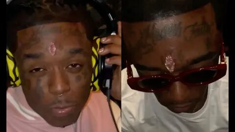 Lil Uzi Gets a $24M Pink Diamond Head Implant. - YouTube