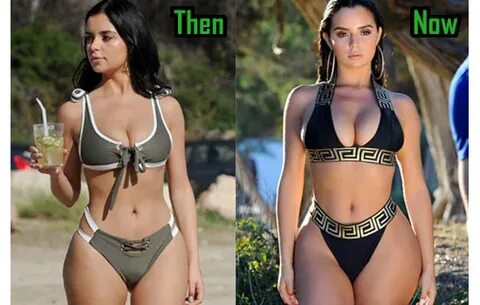 Demi Mawby Plastic Surgery, Boob Job, Before After! - Celebr