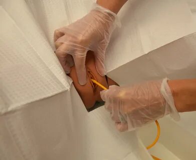 How To Insert A Catheter Female Patient Uk - Asan Josh
