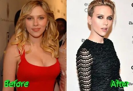 Scarlett Johansson Breast Reduction: Less is More?