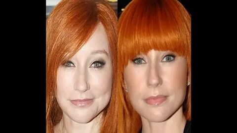 Tori Amos Plastic Surgery Before and After Pictures - YouTub