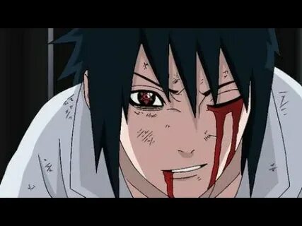 Sasuke is bleeding of his sharingon - YouTube
