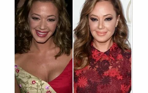 Did Leah Remini Get Plastic Surgery Including Botox and Lips