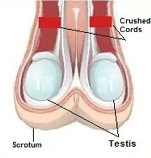 Position of Burdizzo on testes in bloodless castration metho