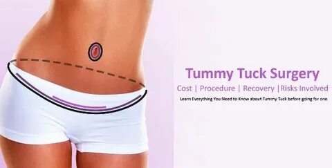 Tummy Tuck: Cost, Procedure, Recovery and Risks. Tummy Tuck 