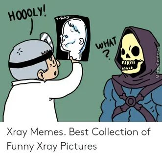 H 000 以 WHAT Xray Memes Best Collection of Funny Xray Pictur
