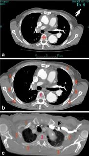 Display examples of the axial CT images on which automatical