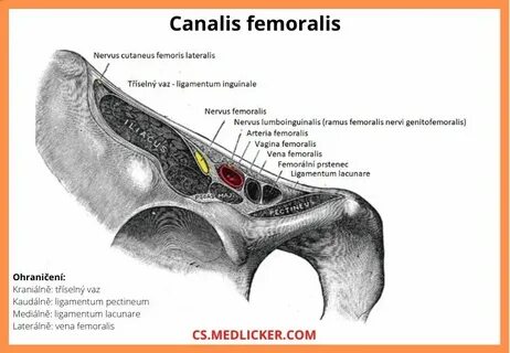 Stehenní kýla (femorální hernie): příčiny, příznaky, diagnos