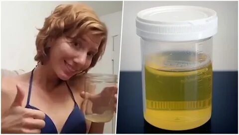 US Woman 'Cures' Acne By Applying Pee On Face! Here's What Y