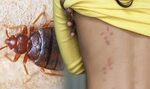 View How To Wash Clothes That May Have Bed Bugs Images - Wal