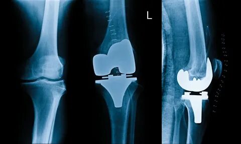 knee-surgeon - London Dr Charles Rivière