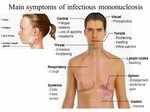 Инфекционный мононуклеоз у взрослых симптомы лечение: Nie zn