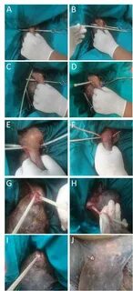 Intraoperative view of the Modified Pinhole castration techn