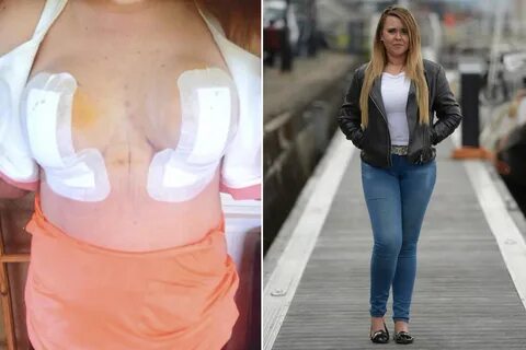 Worlds Biggest Nipples - Sex photos and porn