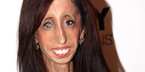 She Was Called The World's Ugliest Woman, Now She's An Inspi