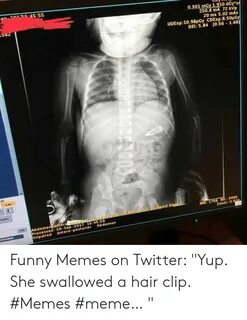 🐣 25+ Best Memes About Funny Xray Meme Funny Xray Memes