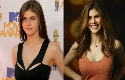 Alexandra Daddario Breast Augmentation and plastic surgery