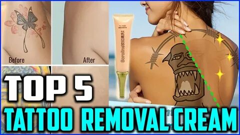 Top 5 Best Tattoo Removal Cream to Buy in 2020 - YouTube