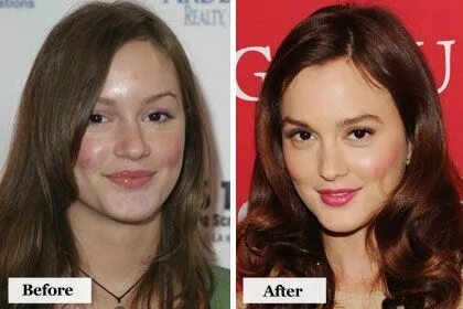 Before They were Famous: Scary Celebrity Hairstyles, Skin an