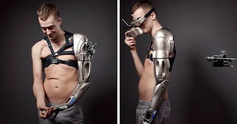 Amputee Gamer Got His Arm Replaced With $75,000 Bionic One, 