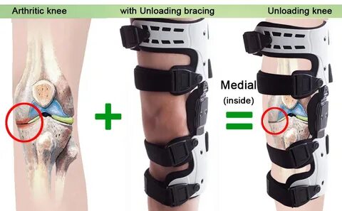 Бандаж на колено OA Unloader-поддержка при боли при артрите,