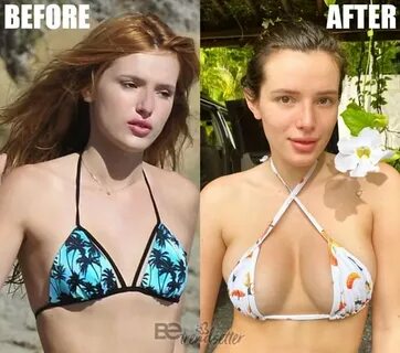 Bella Thorne Plastic Surgery Secrets! Before And After