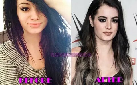 Paige WWE Plastic Surgery Before and After Photos Plastic su