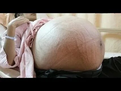 Huge Pregnant Belly Sextuplets - pregnantbelly